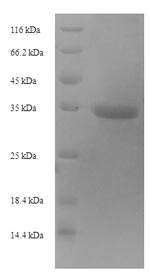 SDS-PAGE