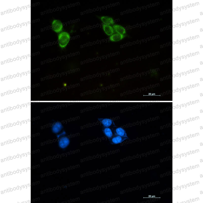 Валидация IF - AntibodySystem RHC82444
