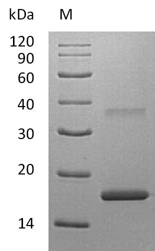 SDS-PAGE