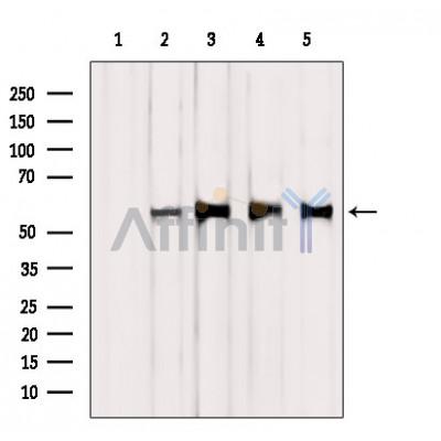 Валидация Affinity DF6603 - 18053