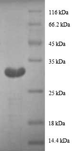 SDS-PAGE