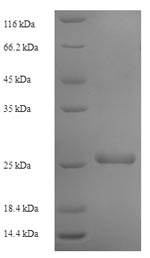 SDS-PAGE