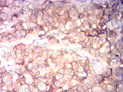 Валидация AntibodySystem RHD03606