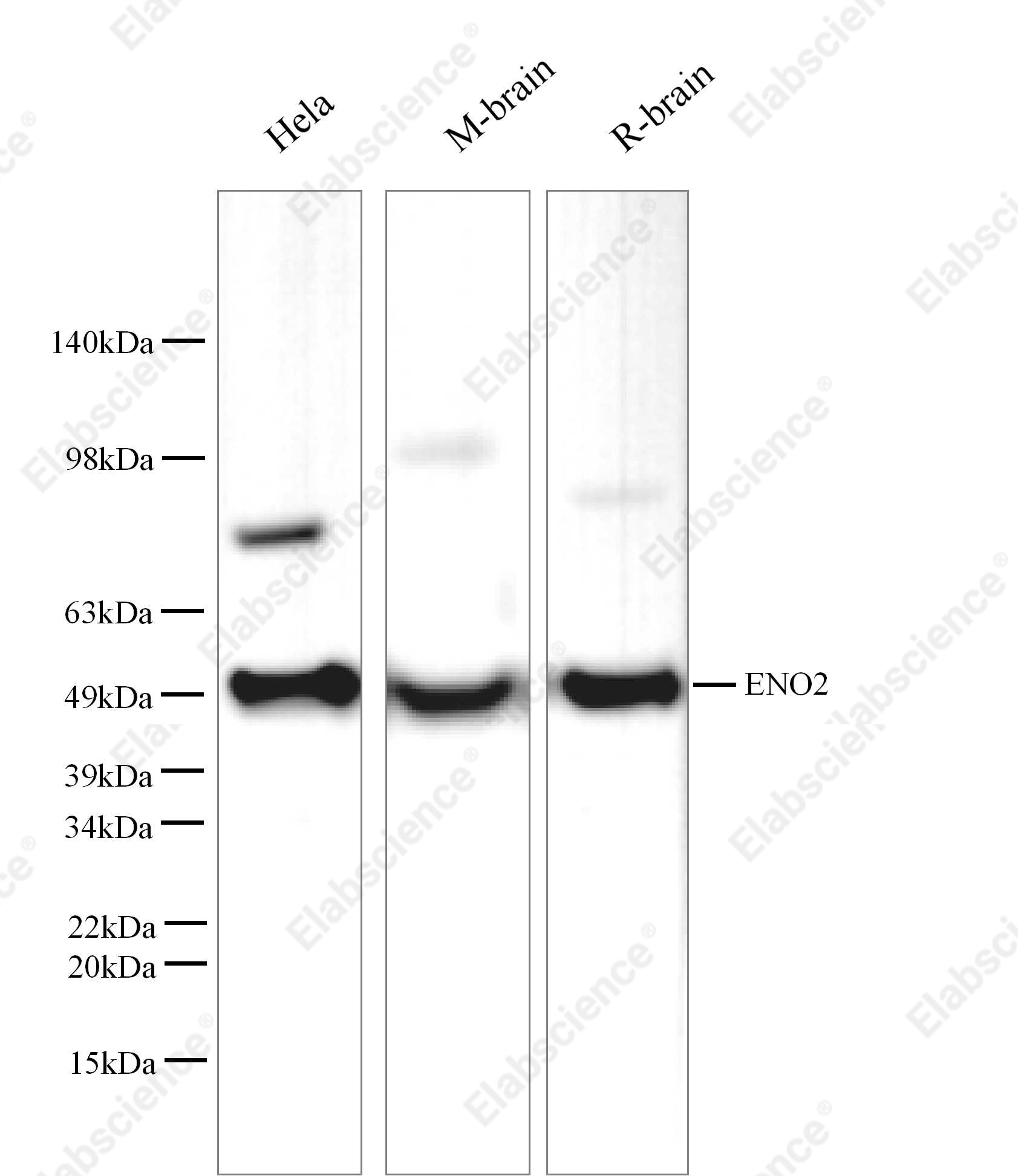 Вестерн-блоттинг, ENO2, клетки SH-SY5Y, HeLa, мозг мыши и крысы