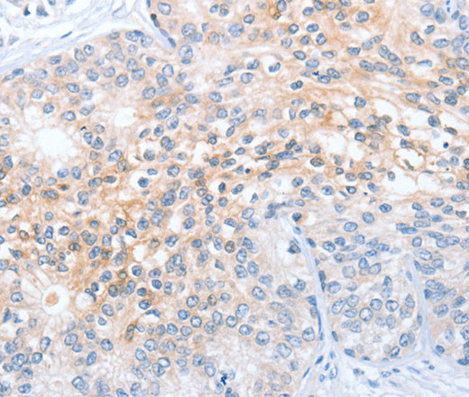 Валидация Elabscience E-AB-11049