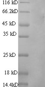 SDS-PAGE