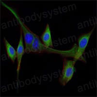 Валидация IF - AntibodySystem RHB91402