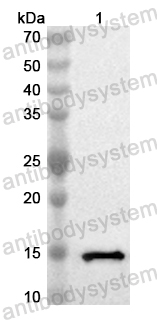 Валидация AntibodySystem PHB26401