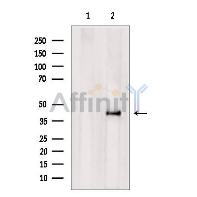 Валидация Affinity DF8558 - 20453