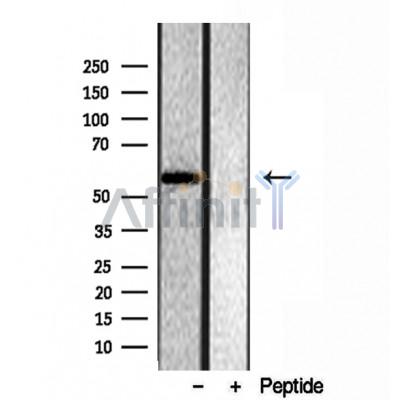 Валидация Affinity DF12082 - 6170