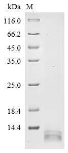 SDS-PAGE