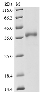 SDS-PAGE