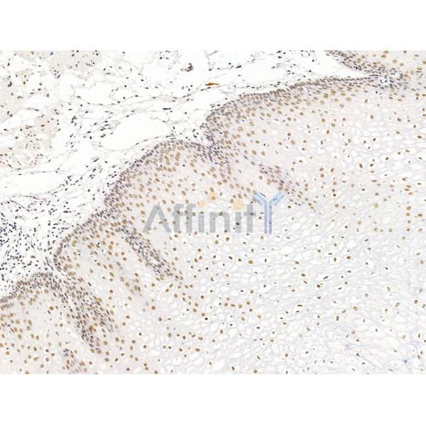 Валидация Affinity DF13543 - 8972