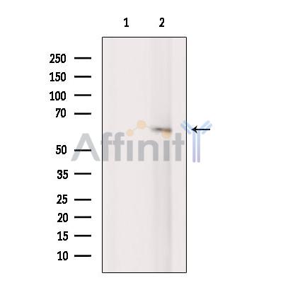 Валидация Affinity DF13448 - 8780