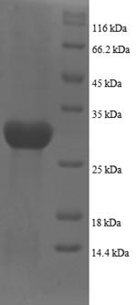 SDS-PAGE
