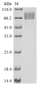SDS-PAGE
