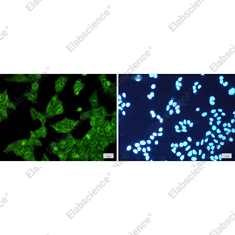 Иммунофлуоресценция, EGFR, клетки HeLa