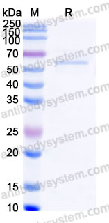 YHE81702, SDS-PAGE