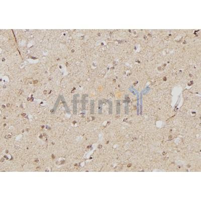 Валидация Affinity AF5387 - 3022