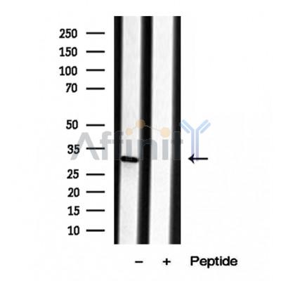 Валидация Affinity DF12025 - 6047