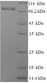 SDS-PAGE