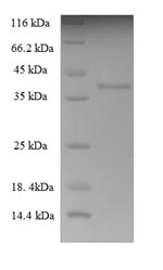 SDS-PAGE