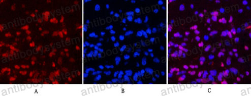 Валидация IF - AntibodySystem RHC20005 (322)