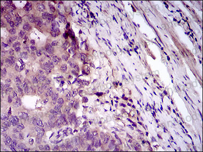 Валидация AntibodySystem RHD37502 (1531)