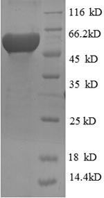 SDS-PAGE