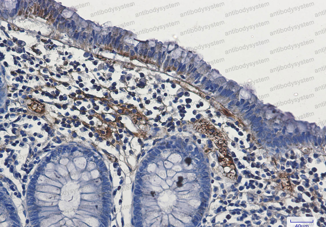 Валидация AntibodySystem RHG04704