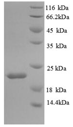 SDS-PAGE