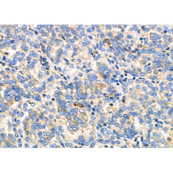 Валидация Affinity DF6672 - 18159