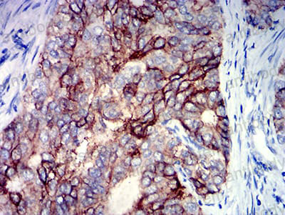 Валидация AntibodySystem RHJ89801 (3574)