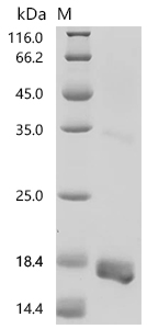 SDS-PAGE