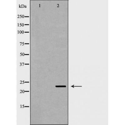 Валидация Affinity DF6590 - 18033