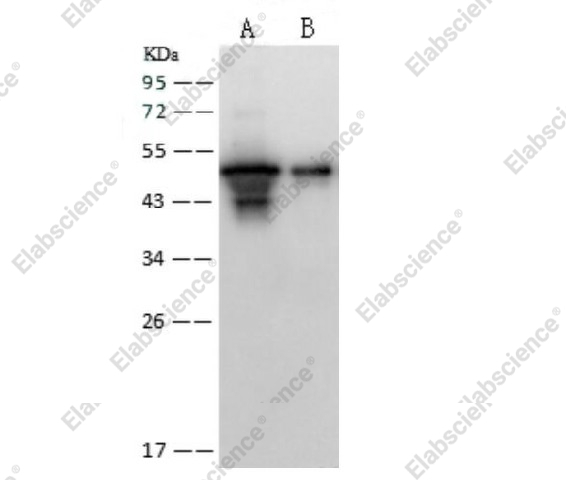 Вестерн-блоттинг, SARS-CoV Nucleoprotein/NP, рекомбинантный белок
