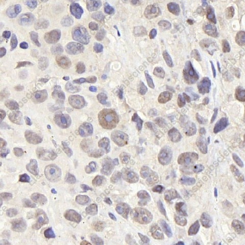 Иммуногистохимия, CDC25A, ткань рака молочной железы мыши
