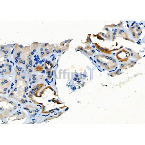 Валидация Affinity DF8023 - 19851