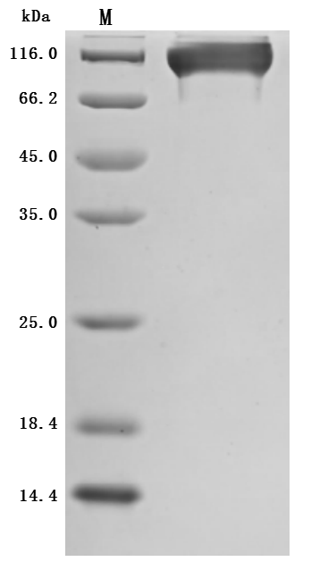 SDS-PAGE