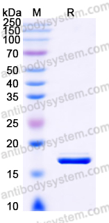 EHB02301, SDS-PAGE