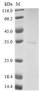 SDS-PAGE