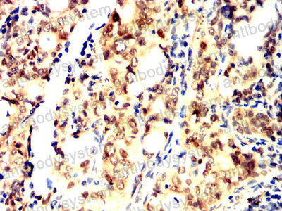 Валидация AntibodySystem RHJ44002 (3410)