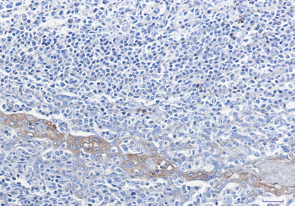 Валидация AntibodySystem RHC88401