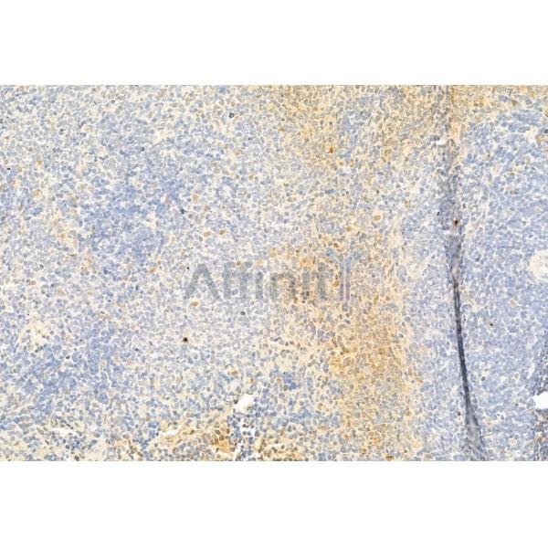 Валидация Affinity DF7037 - 18670