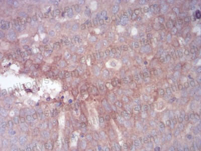 Валидация AntibodySystem RHC30602 (869)