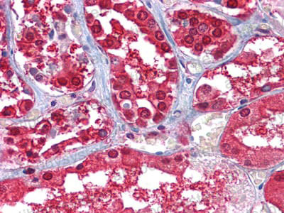 Валидация AntibodySystem RHC21502