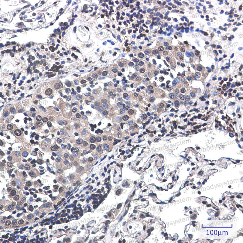 Валидация AntibodySystem RHE88001