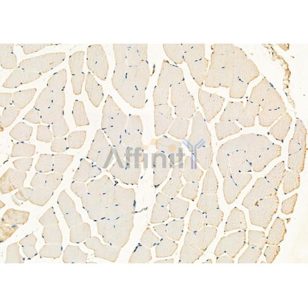 Валидация Affinity DF8581 - 20489