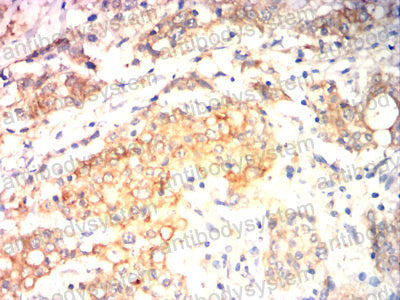 Валидация AntibodySystem RHE77503