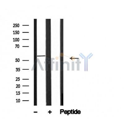 Валидация Affinity AF4717 - 2334